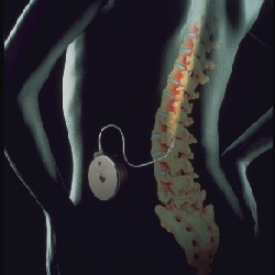 Tratamiento del Dolor Oncológico