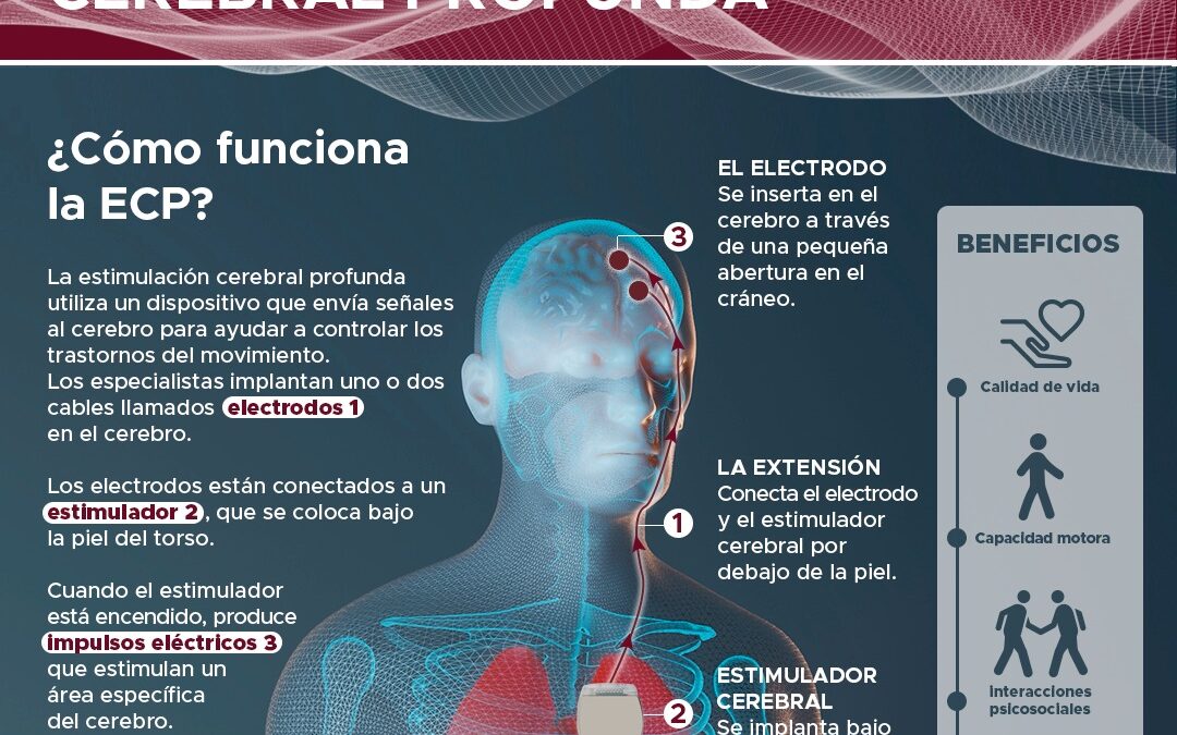 La estimulación cerebral profunda ayuda a que las personas con párkinson recuperen su vida