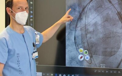 El Clínico San Carlos utiliza por primera vez en España un dispositivo para prevenir lesiones cerebrales en procedimientos cardiacos