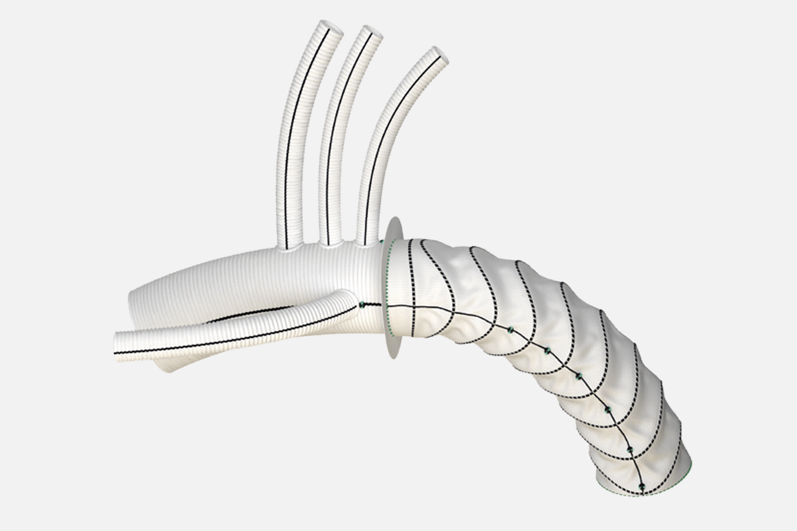 Thoraflex Hybrid_Plexus